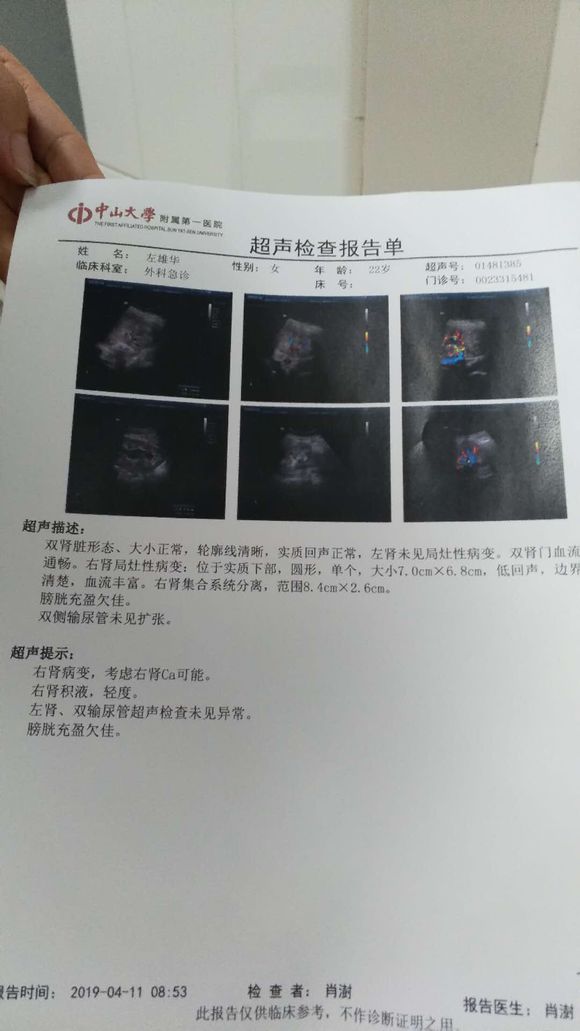 有肾癌的朋友们进来看下,这是什么期的万分感谢|帖子详情页|兴祥肿瘤